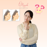 CĂNG DA MẶT TOÀN PHẦN LÀ GÌ?