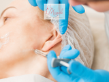 Tiêm Botox Gọn Hàm