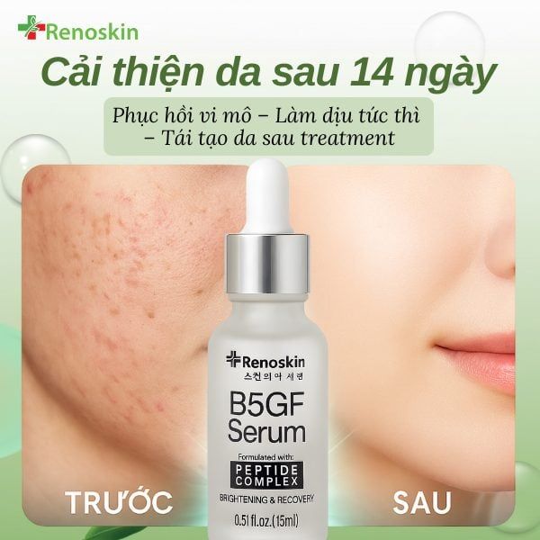 Kết cấu serum B5GF mỏng nhẹ, thấm nhanh và làm dịu da nhạy cảm