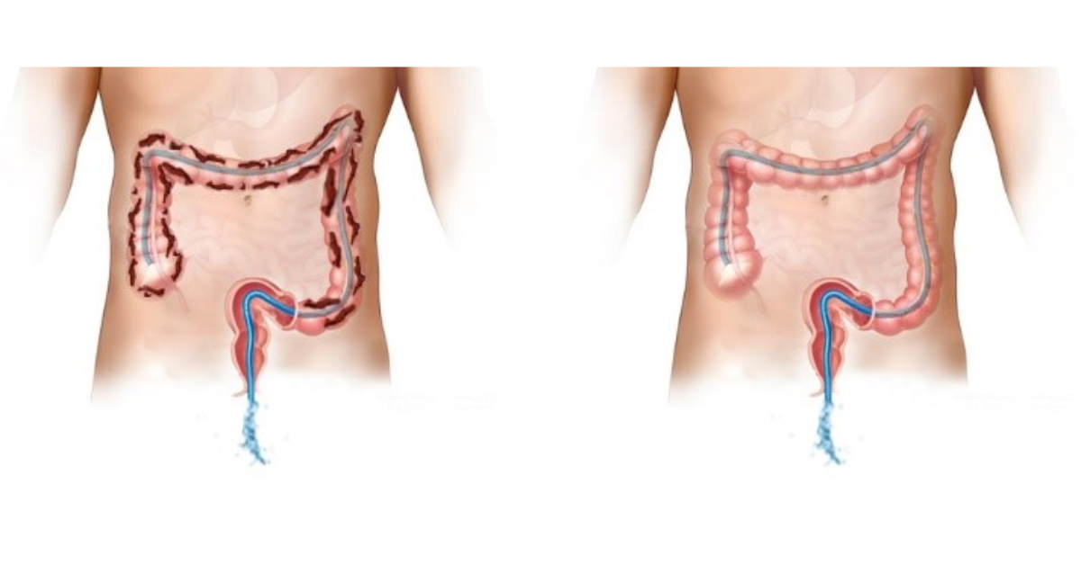 Hỗ trợ thanh lọc cơ thể, cải thiện hệ tiêu hóa
