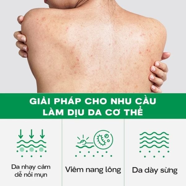 Tinh Chất Dưỡng Thể Làm Sáng Da Và Làm Mờ Đốm Xỉn Màu Skinoxy Pro AHA BHA Concentrate Body Serum