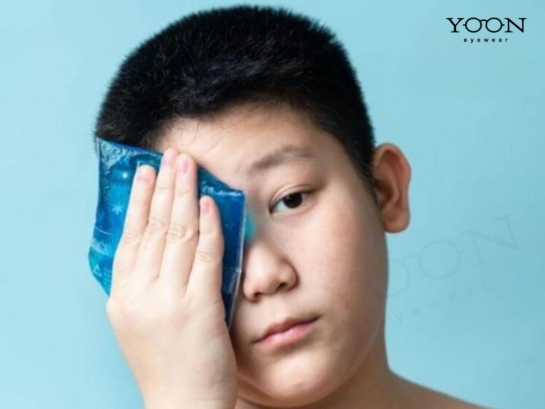 CÁCH GIẢM BẦM MẮT AN TOÀN TẠI NHÀ