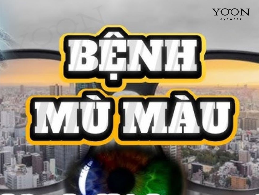 MÙ MÀU HOÀN TOÀN LÀ GÌ?