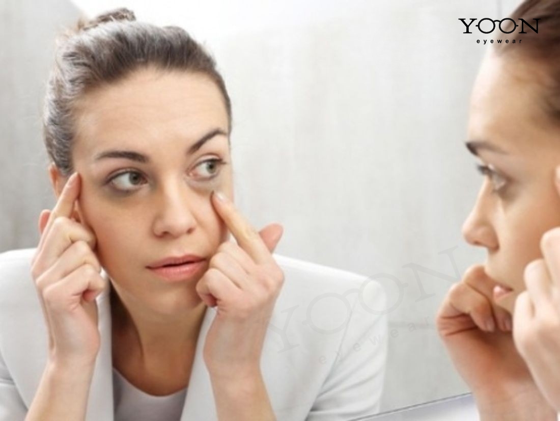 NHỮNG YẾU TỐ LÀM QUẦNG THÂM TRỞ NÊN NGHIÊM TRỌNG HƠN