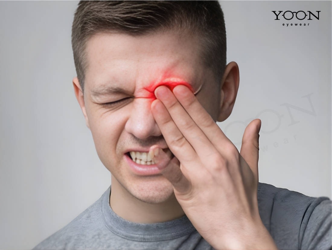 TÌM HIỂU CHUNG VỀ ĐAU HỐC MẮT