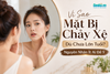 Vì Sao Mặt Bị Chảy Xệ Dù Chưa Lớn Tuổi? Nguyên Nhân Ít Ai Để Ý