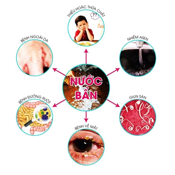 Nước có độ cứng cao sẽ ảnh hưởng rất tiêu cực đến sức khỏe