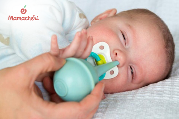 Vệ sinh mũi cho trẻ sơ sinh bằng dụng cụ hút mũi dạng bóp