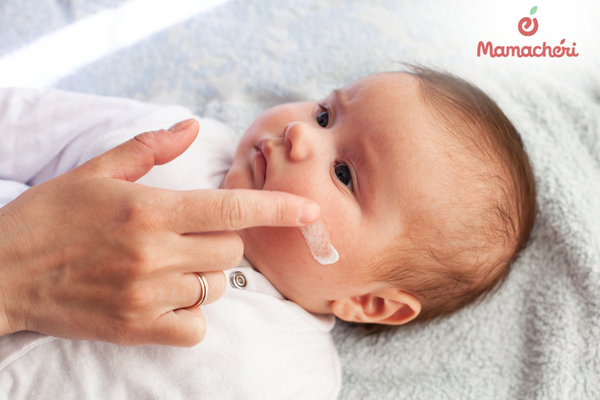 Hướng dẫn cách sử dụng kem chăm sóc da cho trẻ bị chàm sữa