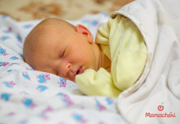 Vàng da ở trẻ sơ sinh là tình trạng da và mắt bé chuyển màu vàng do bilirubin tích tụ trong máu.