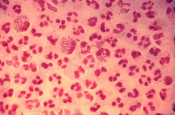 Gentian Violet (C25H30ClN3) nhuộm vi khuẩn