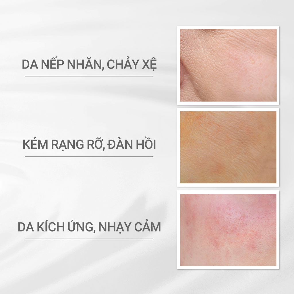 DEAL 10: KEM DƯỠNG NGĂN NGỪA LÃO HÓA D PROGRAM VITALIZING CREAM 45G