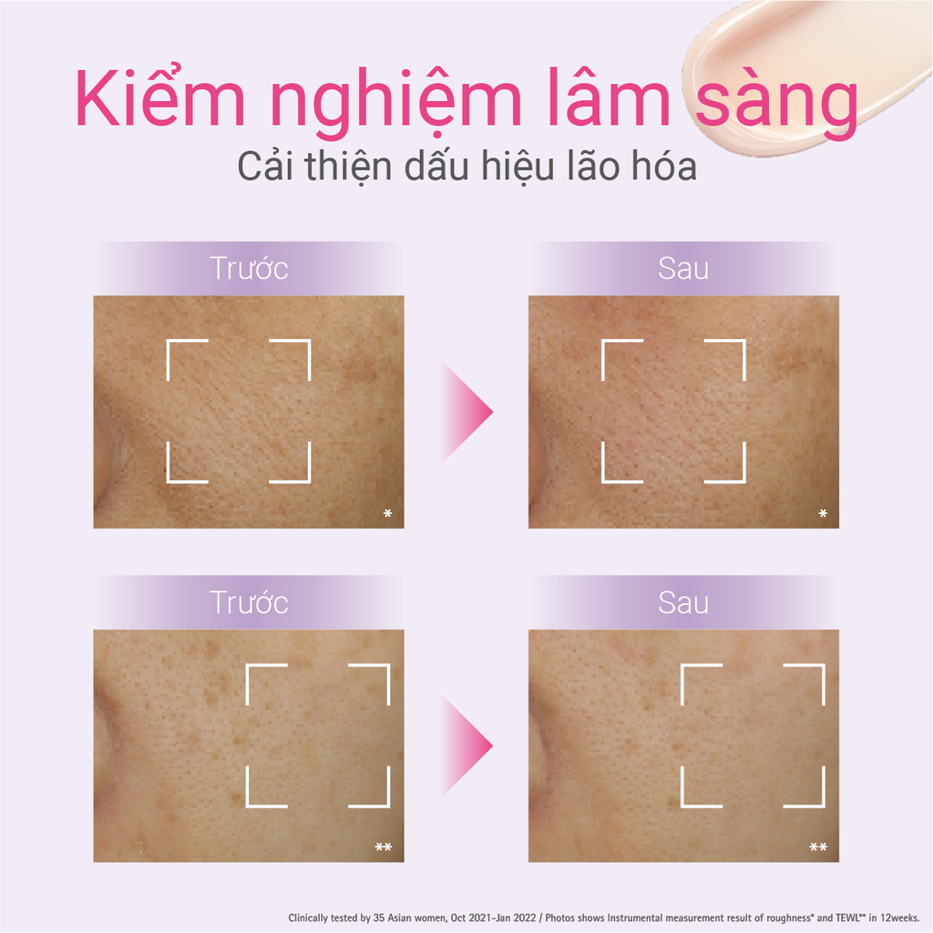 DEAL 10: KEM DƯỠNG NGĂN NGỪA LÃO HÓA D PROGRAM VITALIZING CREAM 45G