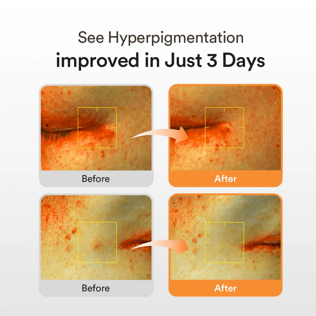 Toner Pad Dưỡng Ẩm, Sáng Da Abib Glutathiosome Dark Spot Pad 220ml (60 Miếng)