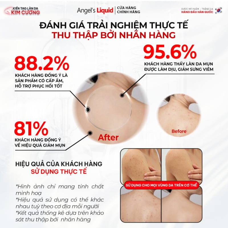 (Mẫu mới) Xịt Hỗ Trợ Giảm Mụn Lưng Angel's Liquid Glutathione+ Spot Care Body Mist 150ml