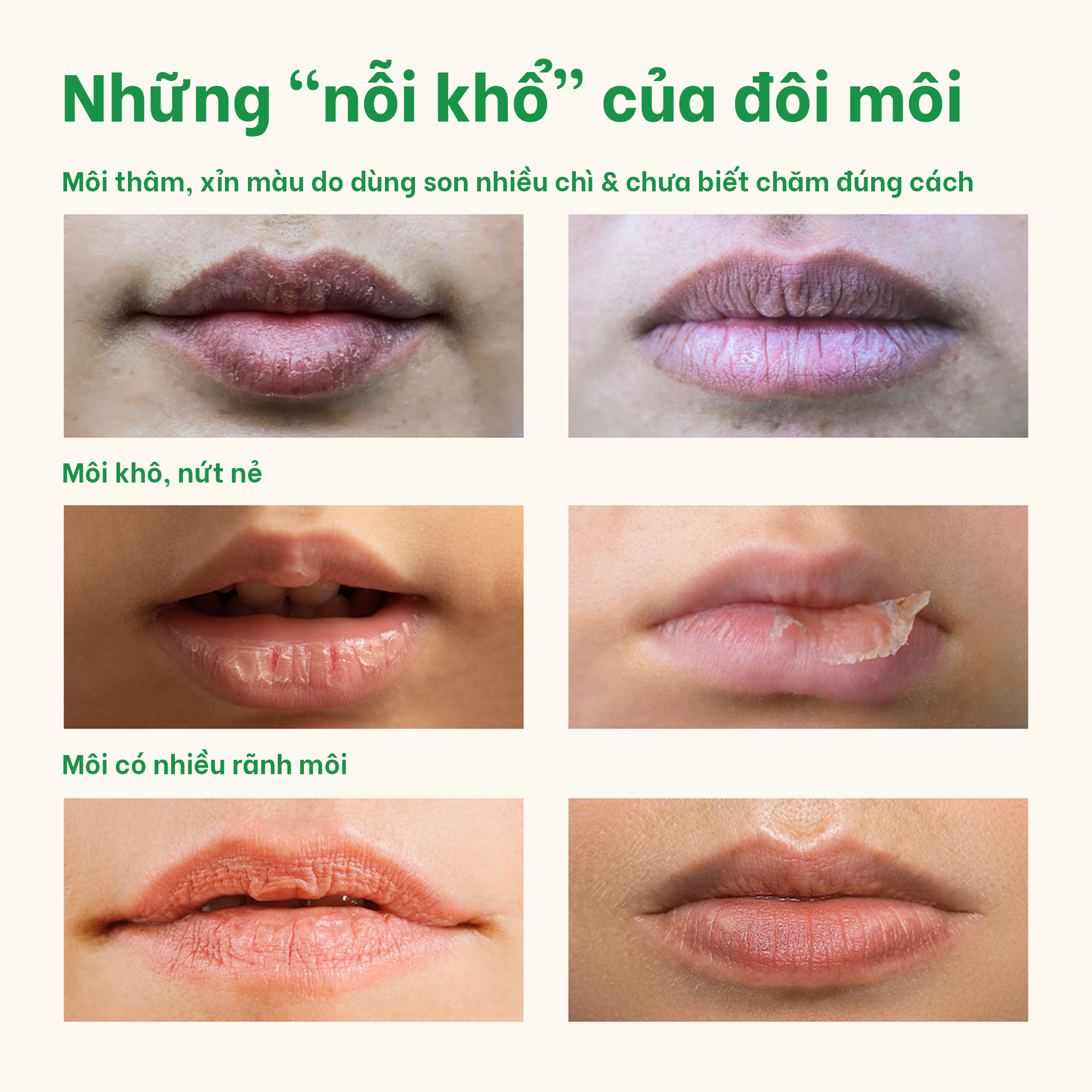 Tẩy Da Chết Kiêm Tẩy Trang Môi BareSoul Best Kisser Lip Scrub & Make Up Remover 20g