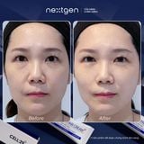 Kem Dưỡng Trắng Phục Hồi CELL:29 Riverfill Repair Cream 40ml