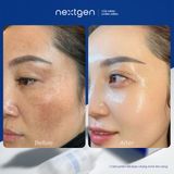 Tinh Chất Collagen Phục Hồi Da CELL:29 Exo-Recure Ampoule 50ml
