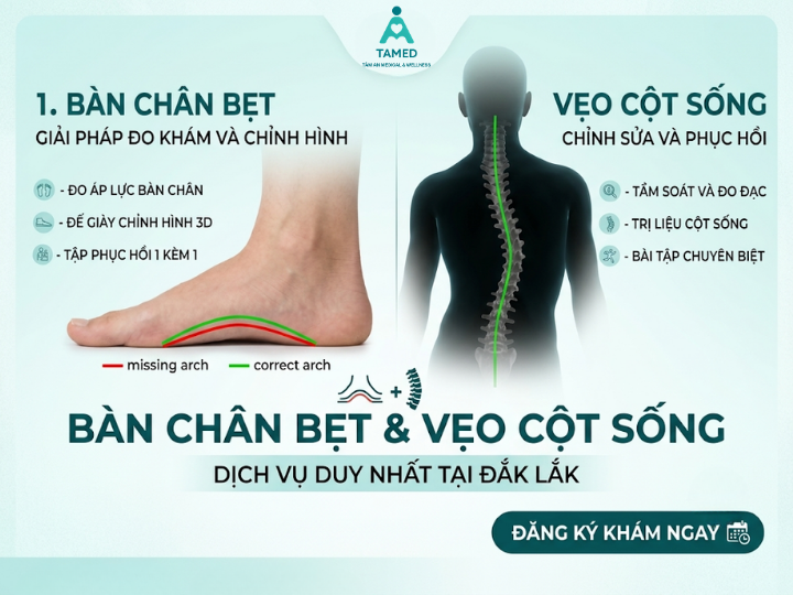 Bàn chân bẹt & Vẹo cột sống