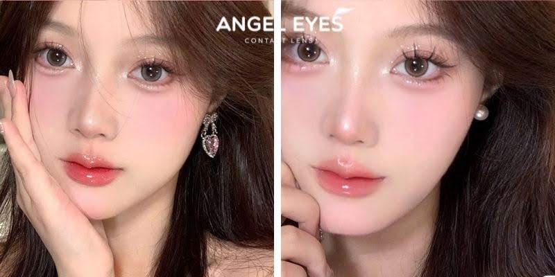 Nguyên nhân khiến đeo lens có thể bị lồi mắt