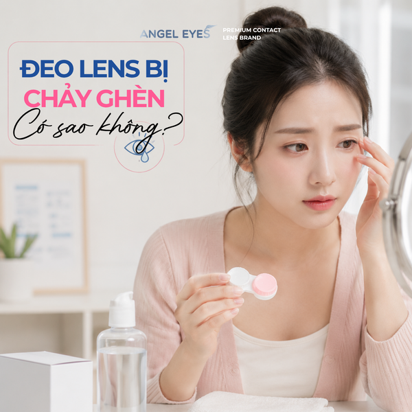 angel-eyes-deo-lens-bi-chay-ghen-co-sao-khong