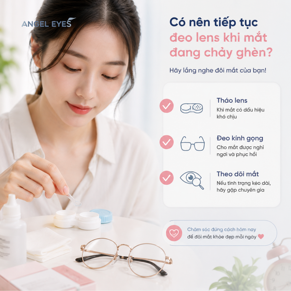 angel-eyes-co-nen-deo-lens-khi-mat-dang-chay-ghen