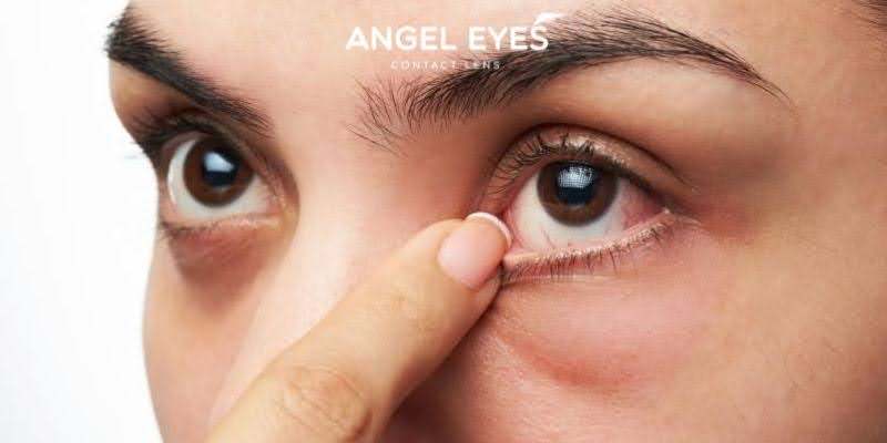 Có nên đeo kính áp tròng khi đi mưa không