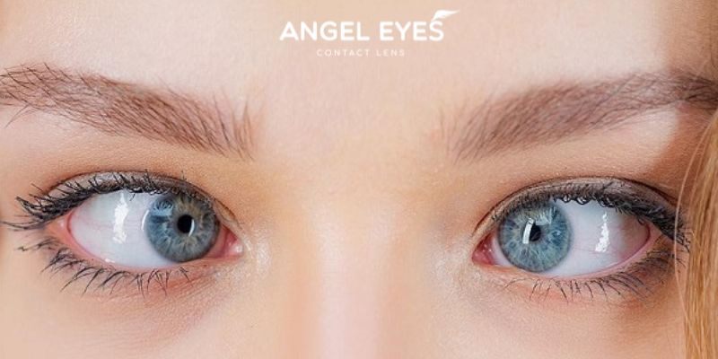 Ưu tiên lens có độ ẩm cao cho mắt bị nhược thị