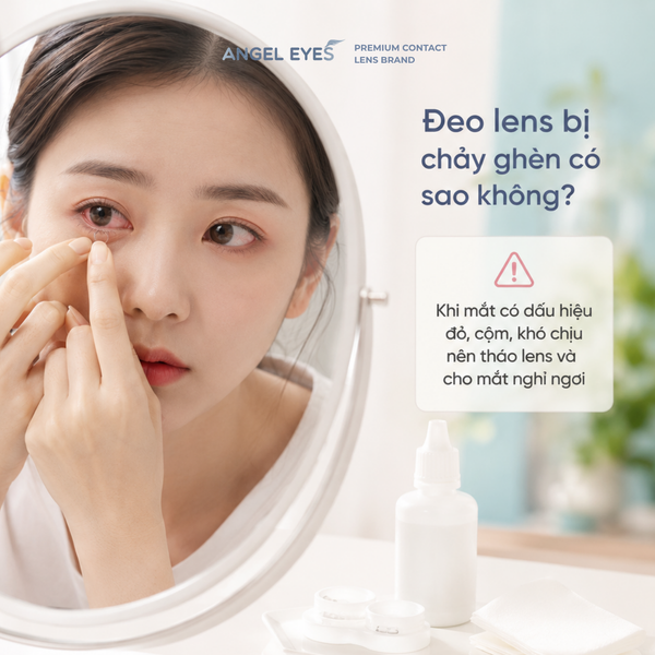 angel-eyes-deo-lens-bi-chay-ghen-muc-do-nguy-hiem