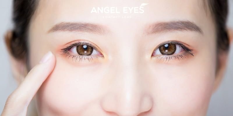 Giới thiệu lens chuyên biệt cho mắt lác