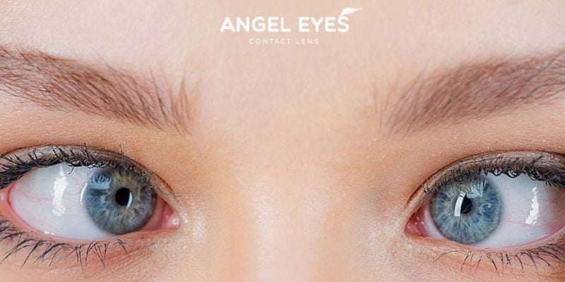 Thăm khám chuyên sâu, bước quyết định mắt lác có đeo lens được không