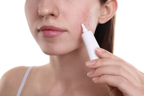 các bước skincare da mụn​