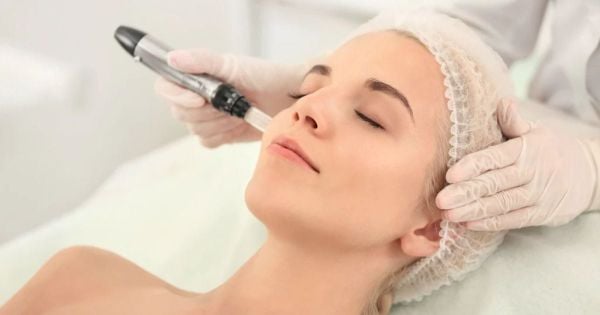 chăm sóc da sau lăn kim