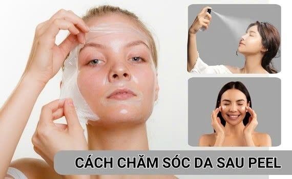 chăm sóc da sau peel