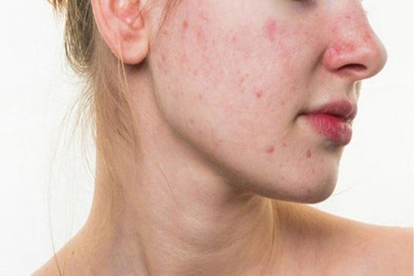 chăm sóc da sau sinh