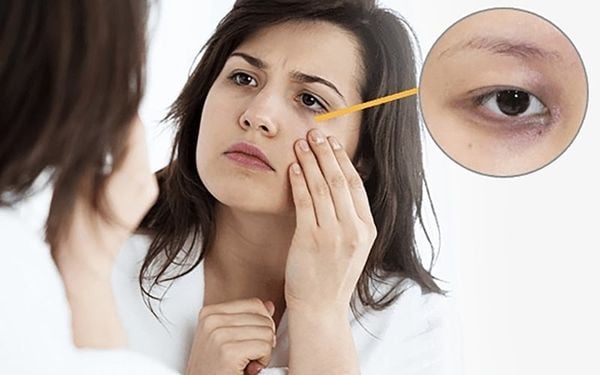 chăm sóc da sau sinh