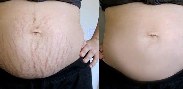 chăm sóc da sau sinh