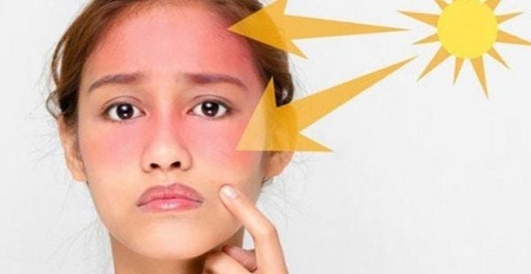 bí quyết chăm sóc da mùa hè