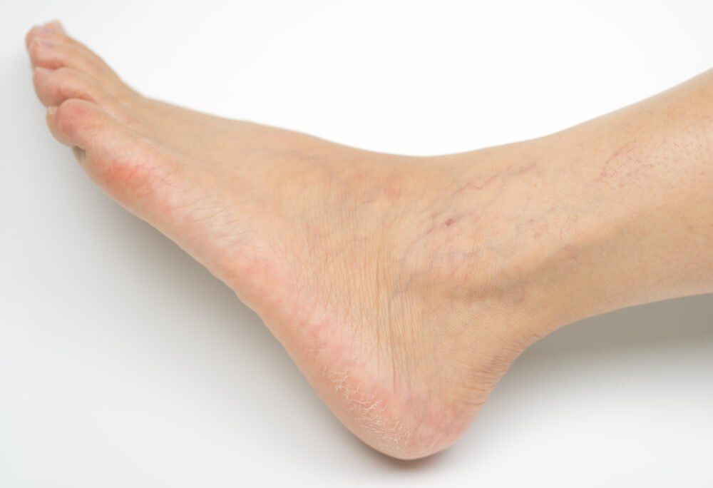 Đứng lâu bị đau chân? Cảnh báo 4 bệnh lý nguy hiểm mà bạn không nên coi thường