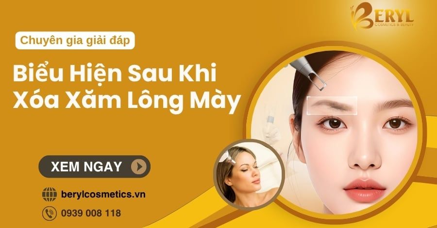 Những biểu hiện sau khi xóa xăm chân mày