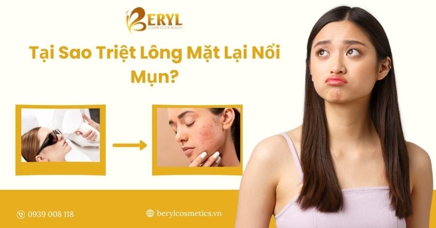 Nguyên nhân triệt lông mặt lại nổi mụn
