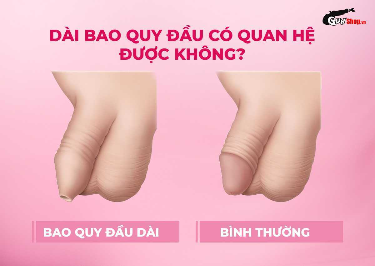 Dài bao quy đầu có quan hệ được không?