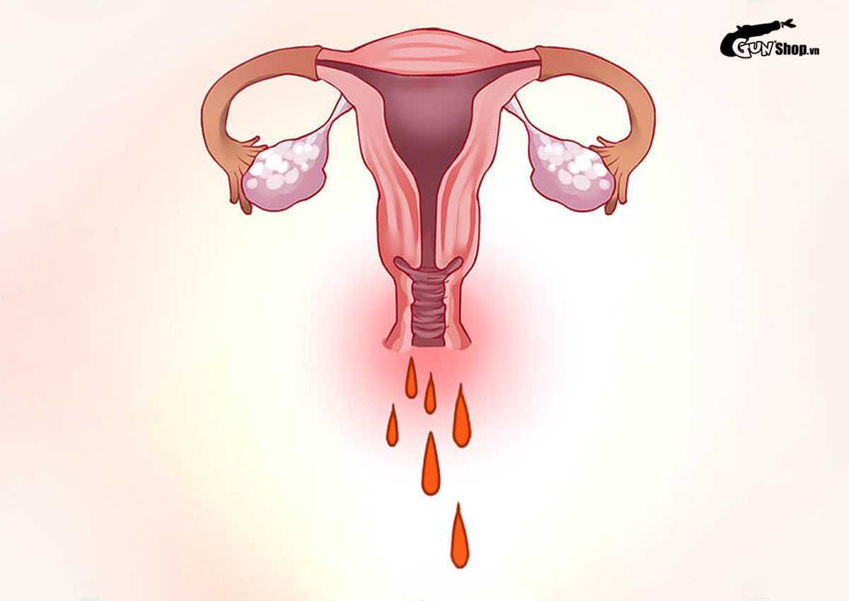 Quan hệ mạnh có ảnh hưởng đến tử cung không?