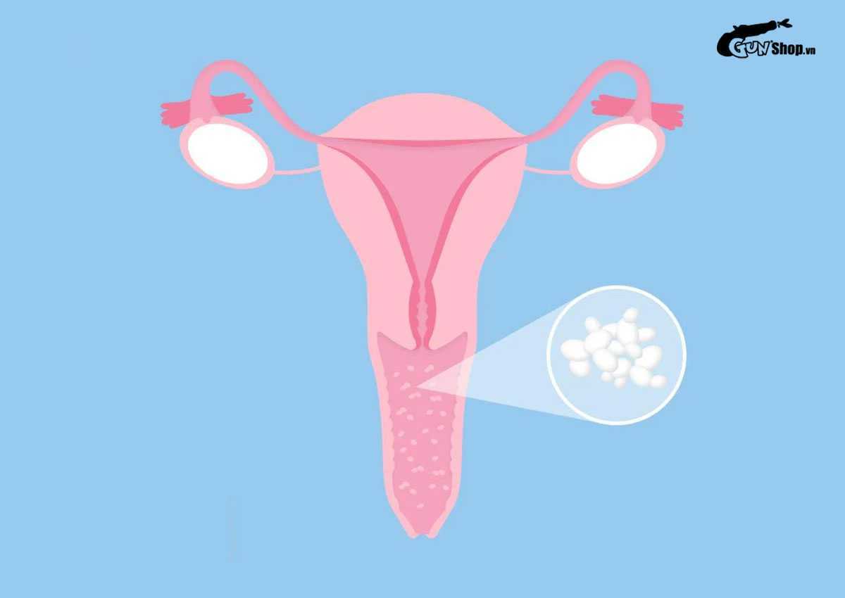 Quan hệ mạnh có ảnh hưởng đến tử cung không?