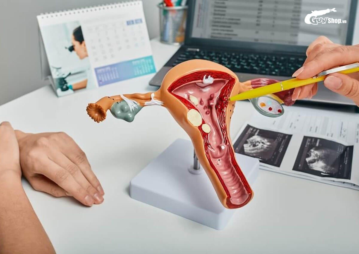 Bị rong kinh sau khi quan hệ có phải bệnh lý phụ khoa không?