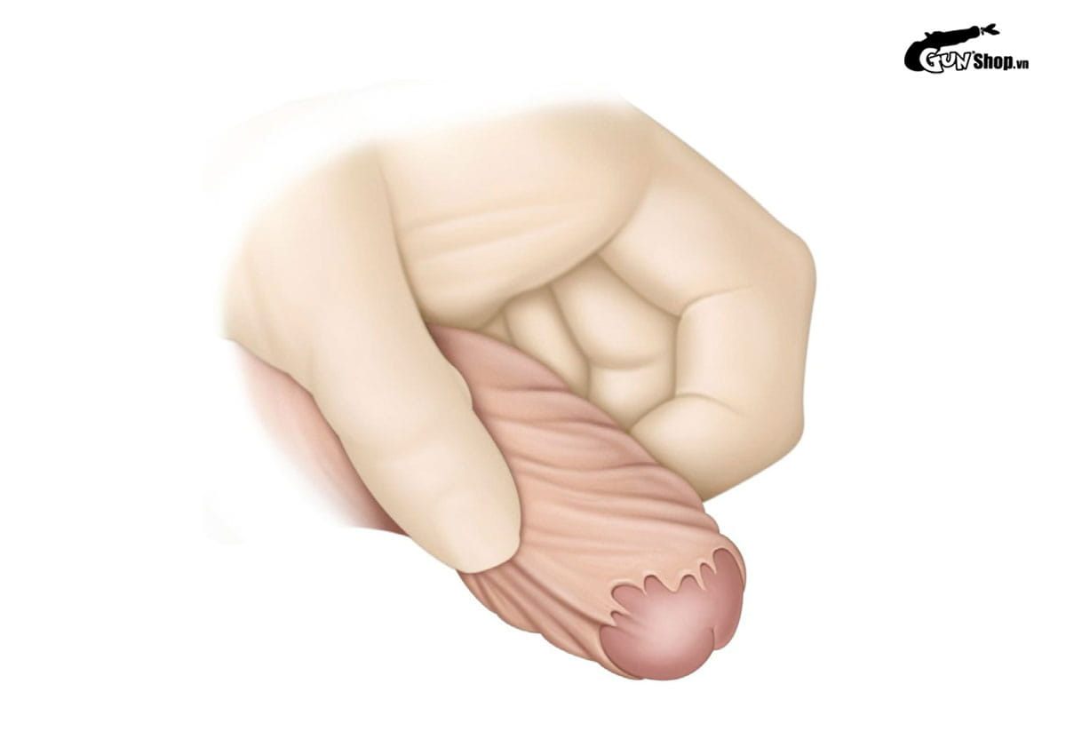 Chảy máu dương vật khi quan hệ có nguy hiểm không?