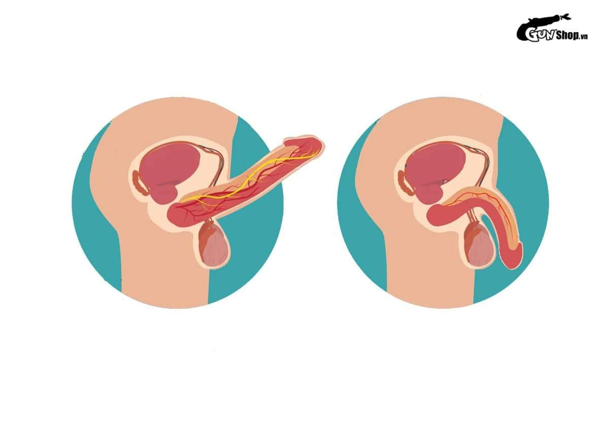 Chảy máu dương vật khi quan hệ có nguy hiểm không?