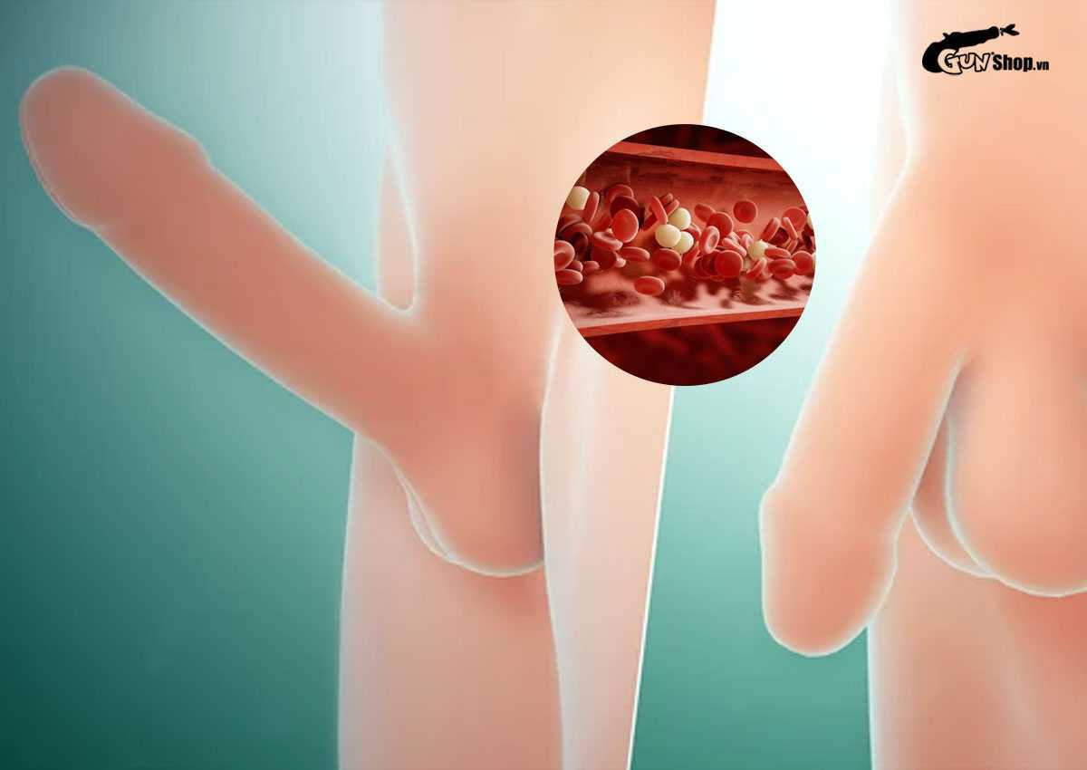 Chữa yếu sinh lý bằng lá lốt có hiệu quả không?