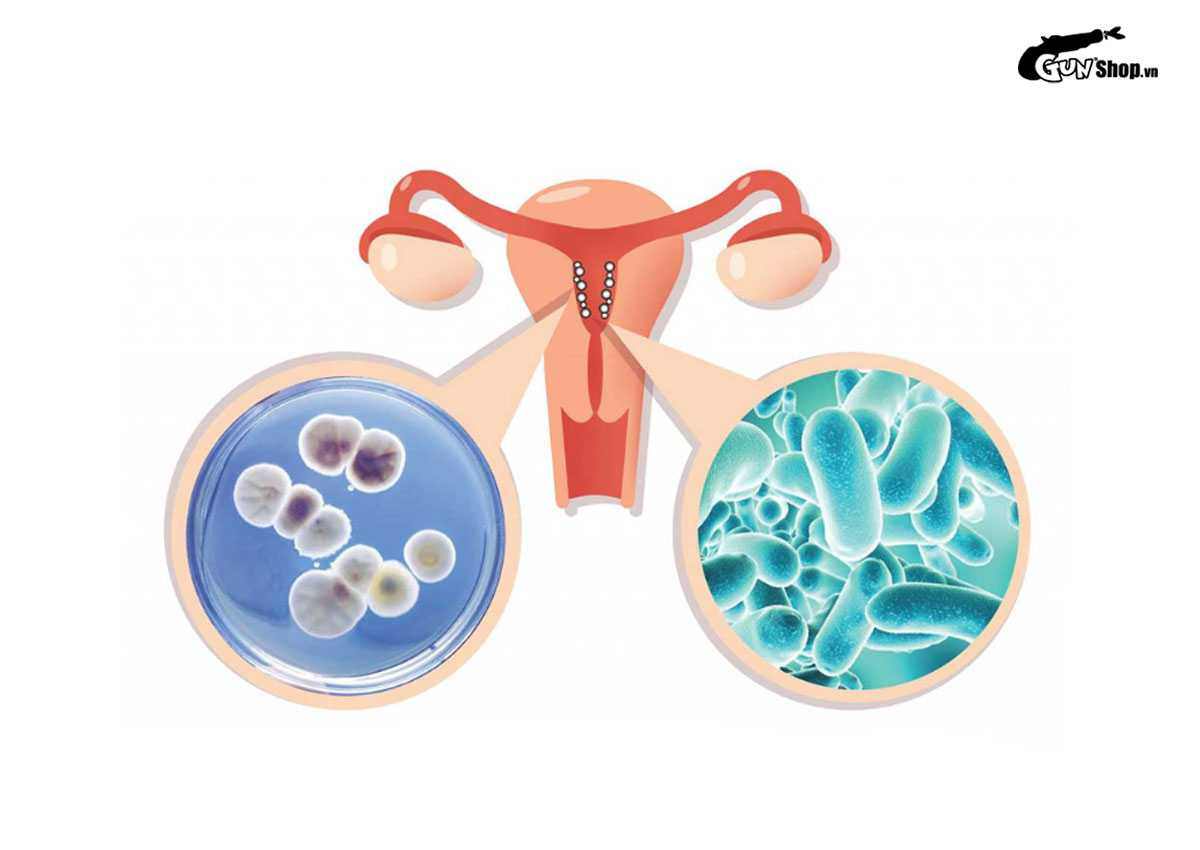 Dùng vaseline làm gel bôi trơn, nên hay không nên?