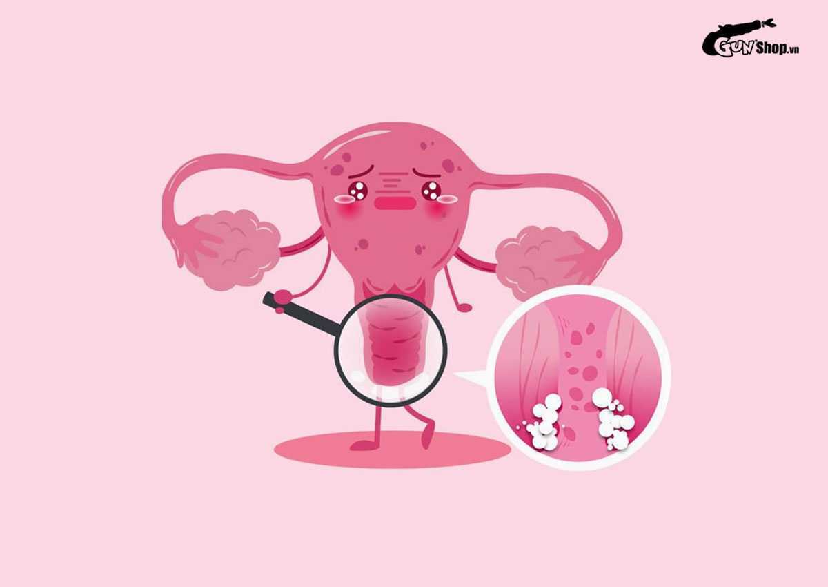 Quan hệ ngày đèn đỏ có bị vô sinh không?